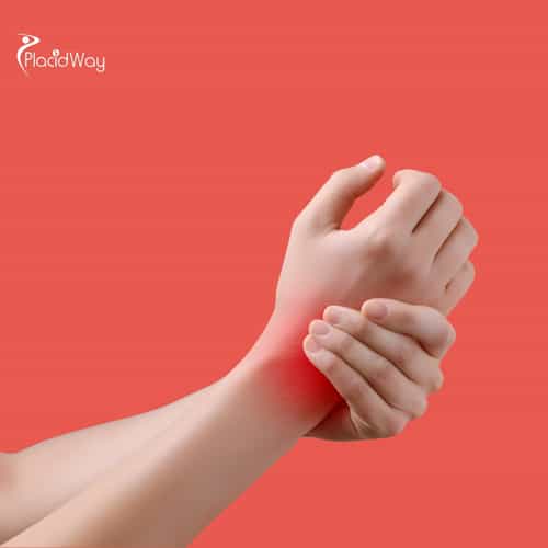 New Path to Healing: U.S. Patient’s Guide to Tendon Injury Stem Cell Treatment in Mexico